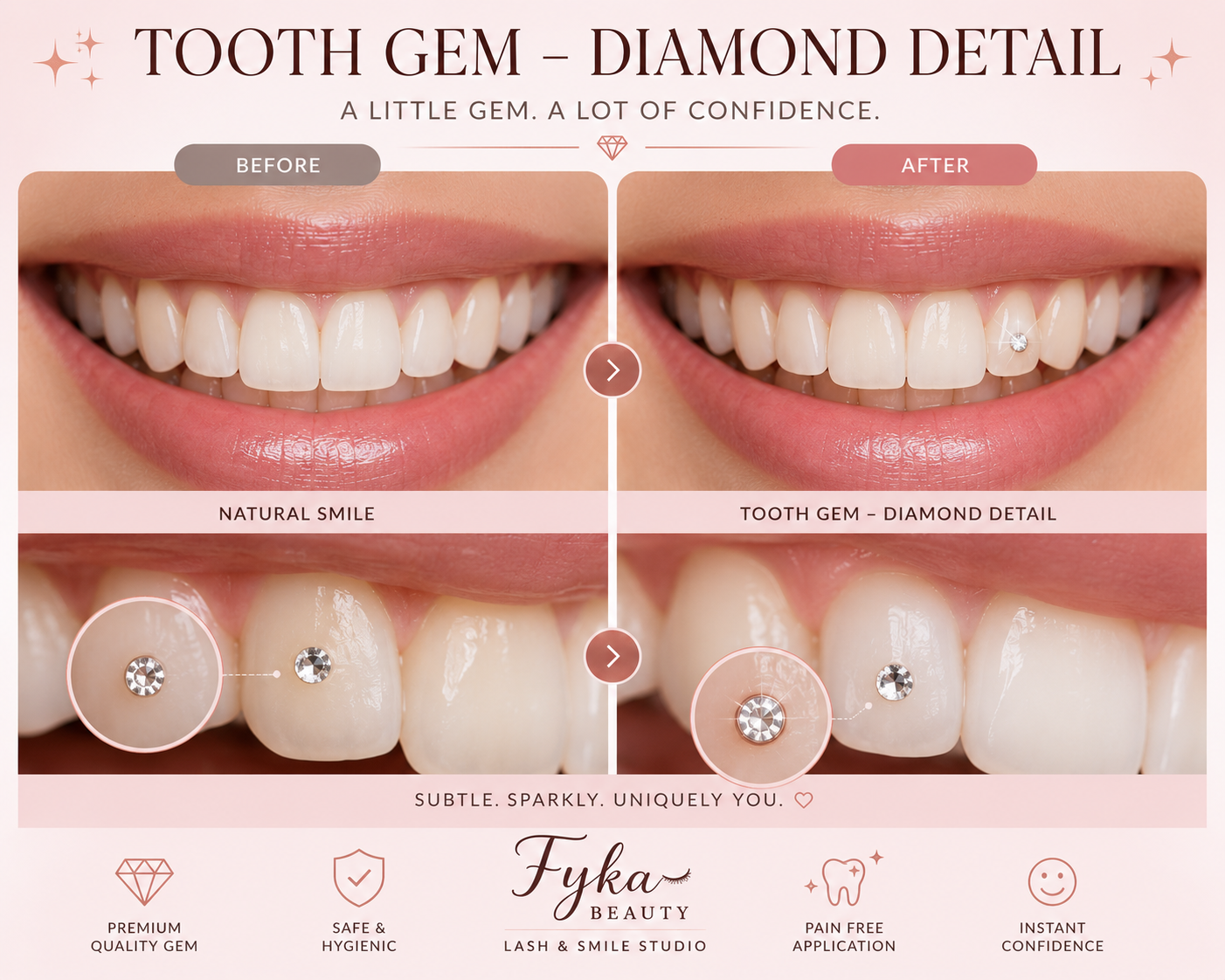 Tooth Gem – Diamond Detail
